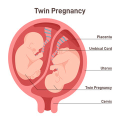 Fototapeta premium Twin pregnancy. Anatomy of womb with twin fetuses. Dizygotic