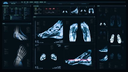 Futuristic Technological Interface Analyzing Human Anatomy. Medical Profile of Patient Showing Feet, Bones, MRI Scan, Respiratory System And Vital Signs. Healthcare Information.
