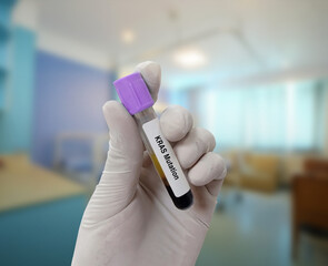 Scientist holds blood sample for KRAS mutation test with patient bed background. Lung cancer test.