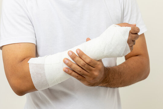 Young man broken arm on isolated background. Asian man put on plaster bandage cast splint. Male patient wearing sling support arm after accident injury. life insurance and accident