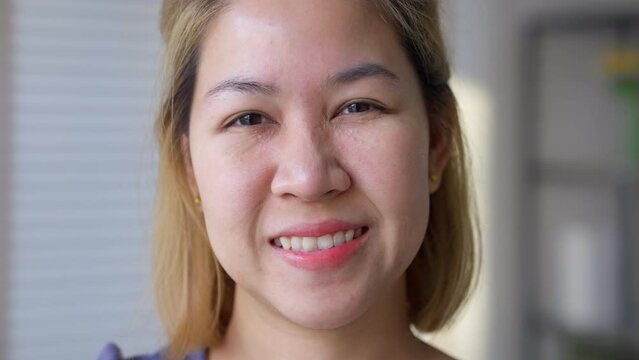 Syringoma milia milium cysts or seborrheic keratosis on asia people female face body care. Close-up young adult asian woman under eye small acne liver spot skin issue smile with pride look at camera.