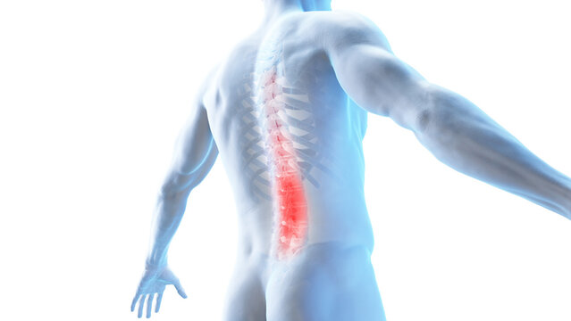 3d rendered medical illustration of a painful back