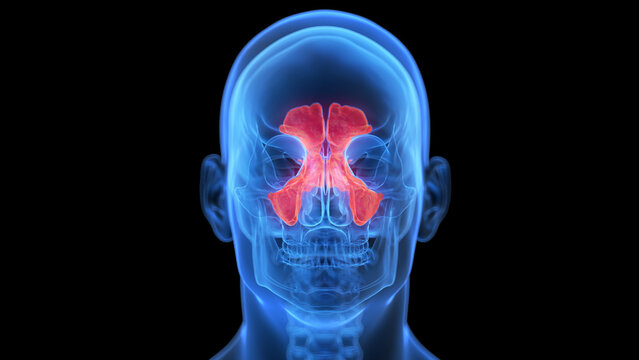 medical illustration