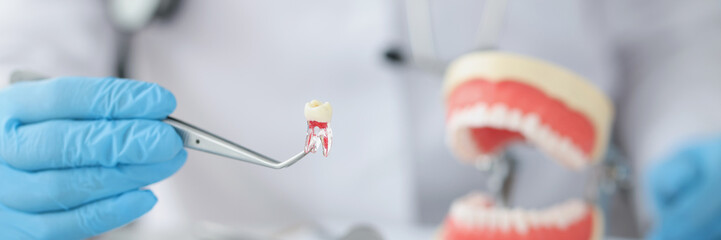 Dentist is holding tooth and dental tool closeup - obrazy, fototapety, plakaty