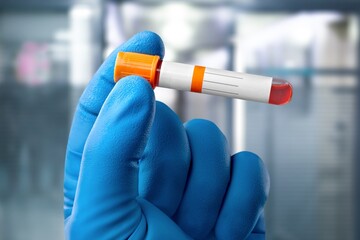 Doctor hand hold sample tube for blood test