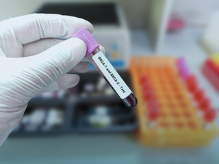 Lab Technologist holds blood sample for BRCA1 and BRCA2 test with laboratory background.