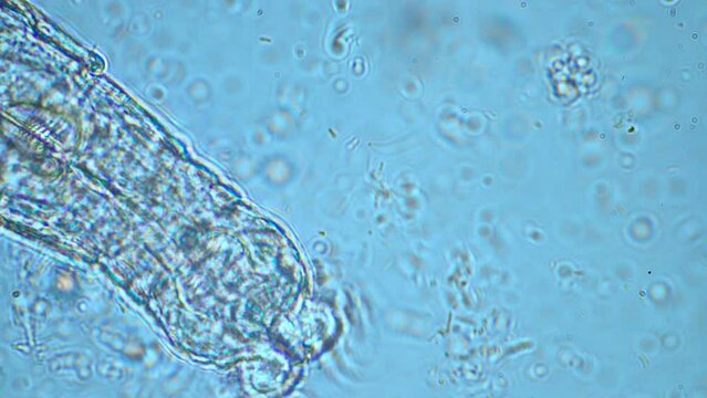 human parasite. gut intestinal infection disease. microorganism infection in hospital 