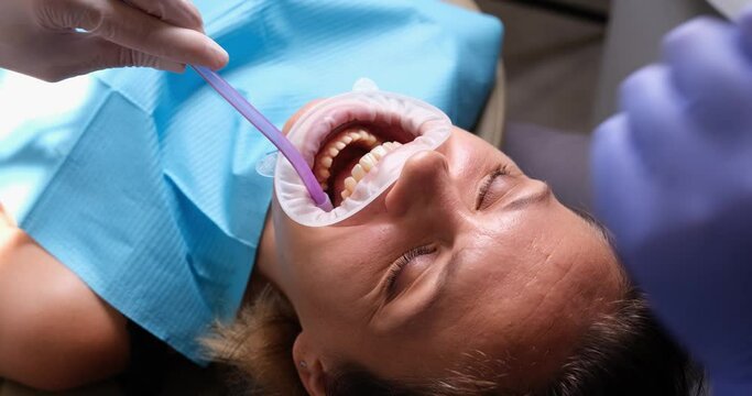 Woman with retractor in mouth in dental clinic and brushing teeth with water