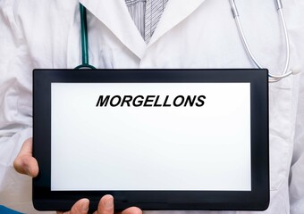 Morgellons.  Doctor with rare or orphan disease text on tablet screen Morgellons