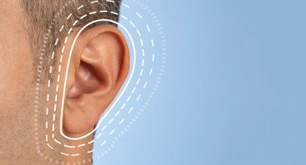 Close up photo of a man with brown skinned ear. Concept of hearing test and ear surgery. - obrazy, fototapety, plakaty