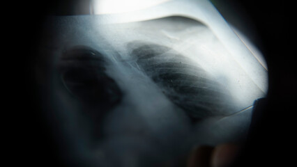 X-ray extreme close-up, doctor making examinations on x-ray, medicine and health care concept