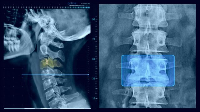 Neck X ray examination loop video