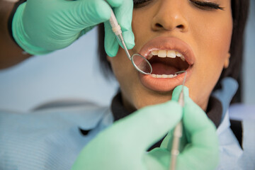 close-up of an african patient's mouth during a dental visit, dental care concept