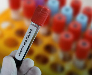 Lab Technologist holds blood sample for  BRCA1 and BRCA2 test with laboratory background. Two genes...