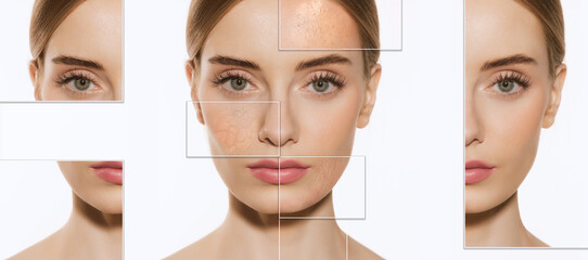 Female skin problems close-up. Beautiful brunette woman and facial diseases: acne, blackheads, dry, oily, wrinkles. White background. Skincare, healthcare, beauty, health, aging process