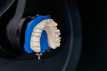 Automatic 3D dental scanner for dental gypsum model scanning and measuring with rotating platform - close up view. Stomatology, medicine, restoration, laboratory equipment and techonology concept