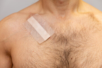 A patch on the chest of a man's body. A wound on the body. Treatment of wounds on the body.