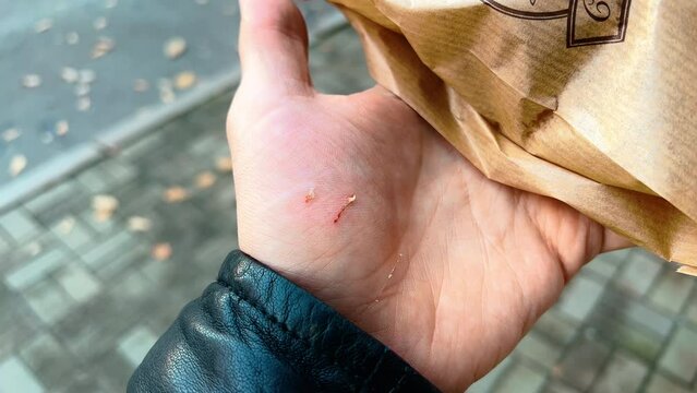 Cratched and damaged male hand with visible red blood outdoors