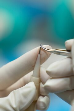 Close up of surgeon's hand placing a follicular unit in the needle for hair transplantation.