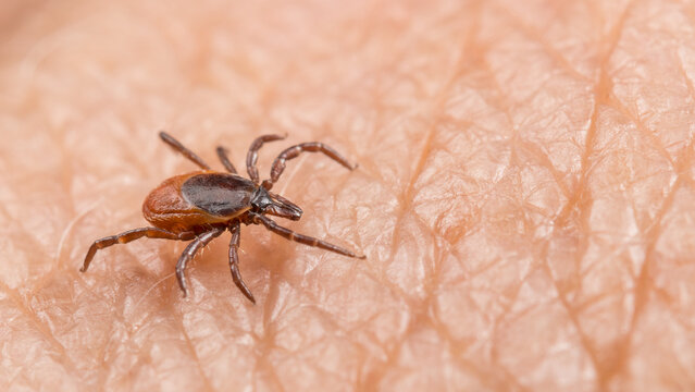 Closeup of female deer tick parasite on human skin background. Ixodes ricinus. Dangerous parasitic insect mite on pink textured epidermis. Carrier of tick-borne diseases as encephalitis or babesiosis.