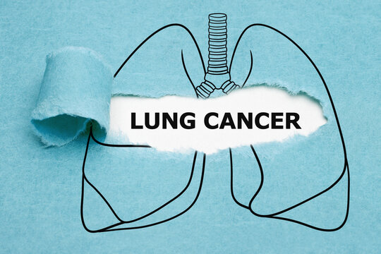 Lung Cancer Drawn Concept