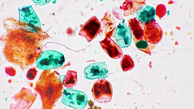 Macro footage of rotifera whole mount under laboratory microscope 100x on bright field background. Closeup of planktons called wheel animals enlarged for detailed research. Wild aqua organism