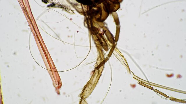 Mouthpart of mosquito whole mount in scientific slide shown under microscope 100x against bright field background. Head of bloodsucker with tiny needle and legs multiply magnified. Biting insect