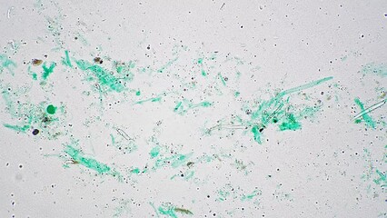 Microscopic footage of scientific slide with rhizopus whole mount magnified in 100 times on bright field background. Macro laboratory slide of genus of the fungi made for educating its structure.