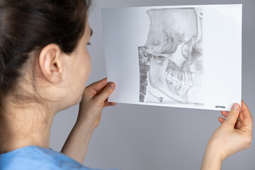 The doctor holds a CT scan of a patient with temporomandibular joint dysfunction and malocclusion.