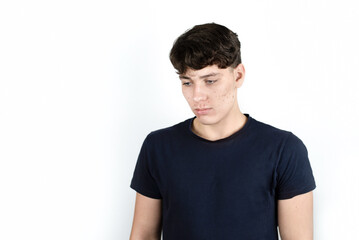 Fototapeta premium Portrait of a sad teenager boy on a light background, he looks to the side and down, the boy has problems with the skin of his face, many pimples and blackheads