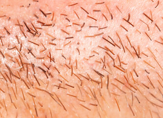Hair on the skin of a man's face. Macro