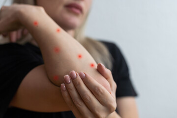 Naklejka premium ill allergic rash dermatitis eczema skin of patient