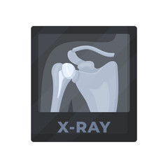 X-ray of the human scapula. A study of the internal structure of objects that are projected with x-rays. Black and white x-ray.
