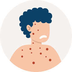 The symptom of the disease is a rash all over the body itching