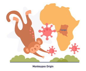 Monkeypox virus infographic. African origin, viral disease from Republic
