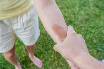 Man's hand keep woman's hand with bruise. Violence against women. Battering a woman and domestic violence