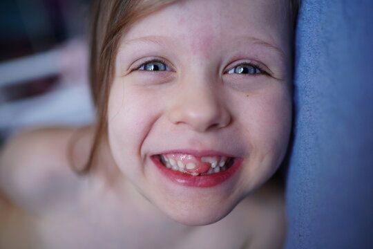 Cheerful Girl Without Front Teeth