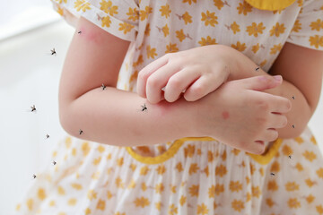 Little girl has skin rash allergy and itchy on her arm from mosquito bite - obrazy, fototapety, plakaty