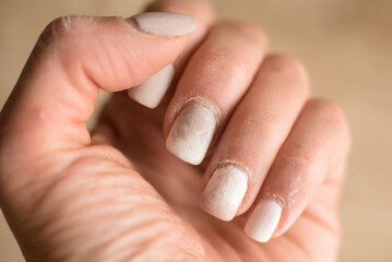 Manicure requires correction. Overgrown manicure. Female hands with overgrown nails. Time for correction gel polish.