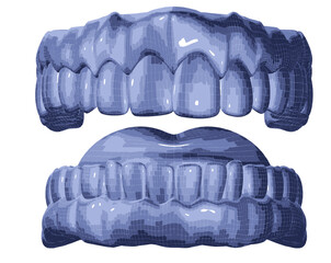 Molde de dentadura. Férula y estetica dental.