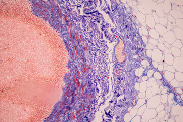 Tissue of Blood human, Vein human, Artery human and Heart muscle human under the microscope in Lab.