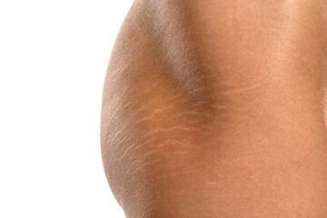 Female tanned hips with a stretch marks and cellulite on white background.