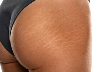 Female tanned hips with a stretch marks and cellulite on white background.