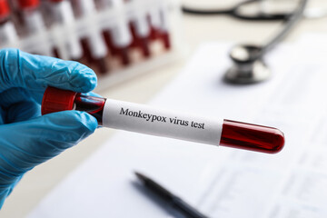 Laboratory worker holding test tube with blood sample over table, closeup