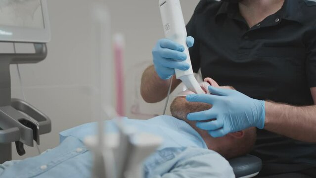 A male orthodontist doctor scans a man's teeth and jaw in the clinic's medical office. Creates a 3d model with an intraoral manual 3d scanner. Diagnosis of caries. Dentist's office in the clinic.