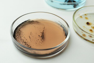 Petri dishes with different bacteria colonies on white background, closeup