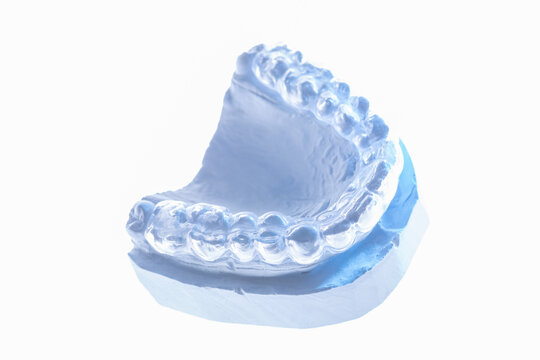 farblose Aufbissschiene  auf Gipsmodell, Entlastung der Zahn-Muskel-Gelenkfunktion, blau angestrahlt, wei&szlig;er Untergrund.