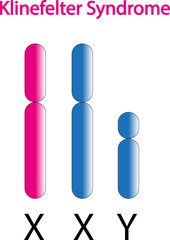 Scientific conception of Klinefelter syndrome (XXY). Colorful symbols. Vector illustration.