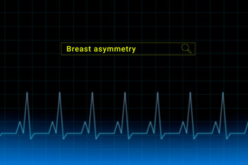 Breast asymmetry.Breast asymmetry inscription in search bar. Illustration with titled Breast asymmetry . Heartbeat line as a symbol of human disease.