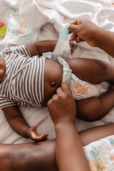 African baby and female hands changing his diapers